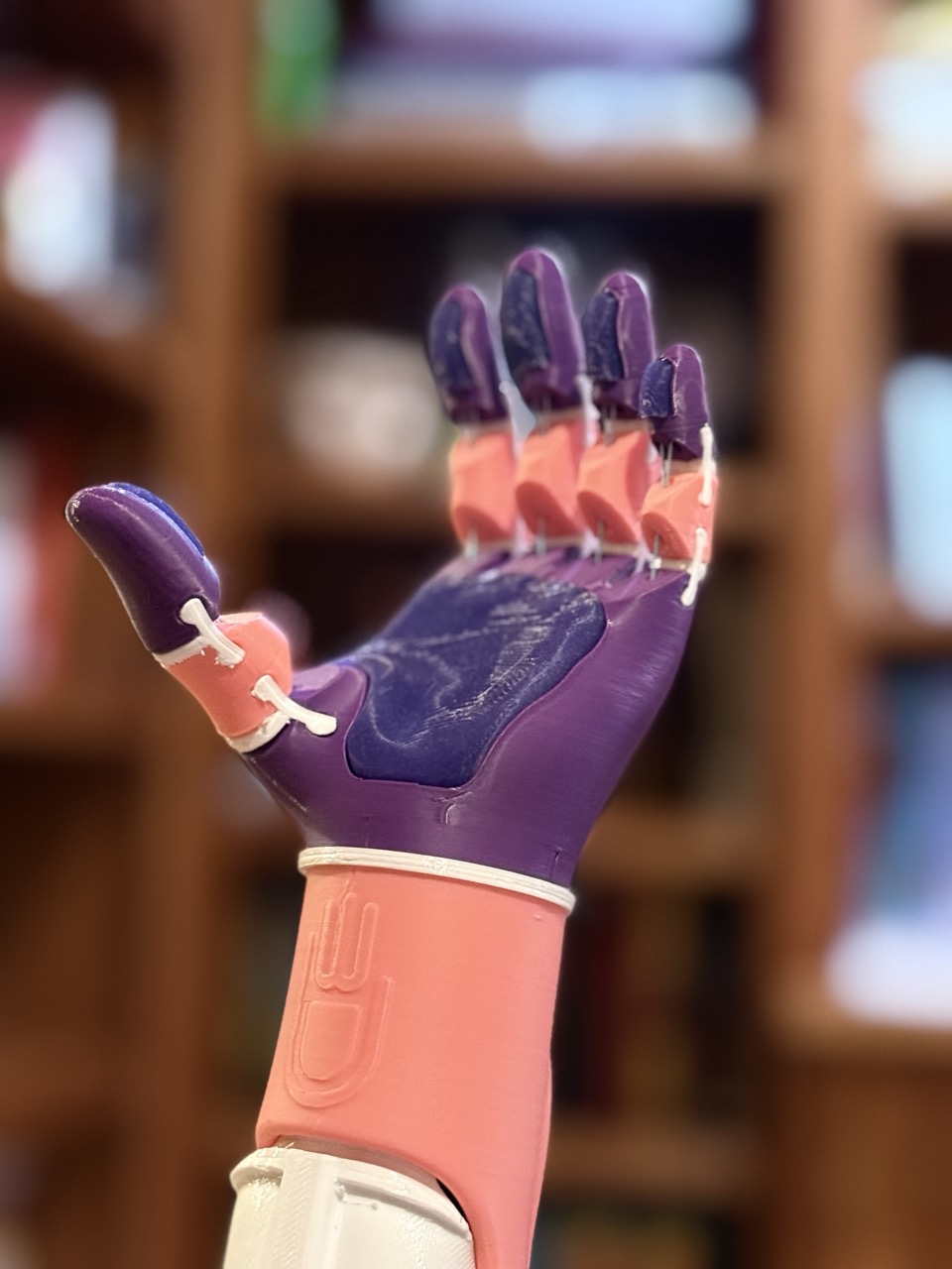 S.'s pink and purple prosthetic arm raised upward, fingers extended, photographed from below against a warm blurred background